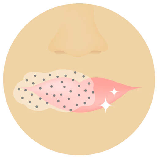 Illustration der Lippen einer Person mit Slaai und Bambus Booster auf einem Teil von ihnen